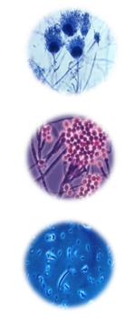 candida en gisten.PNG